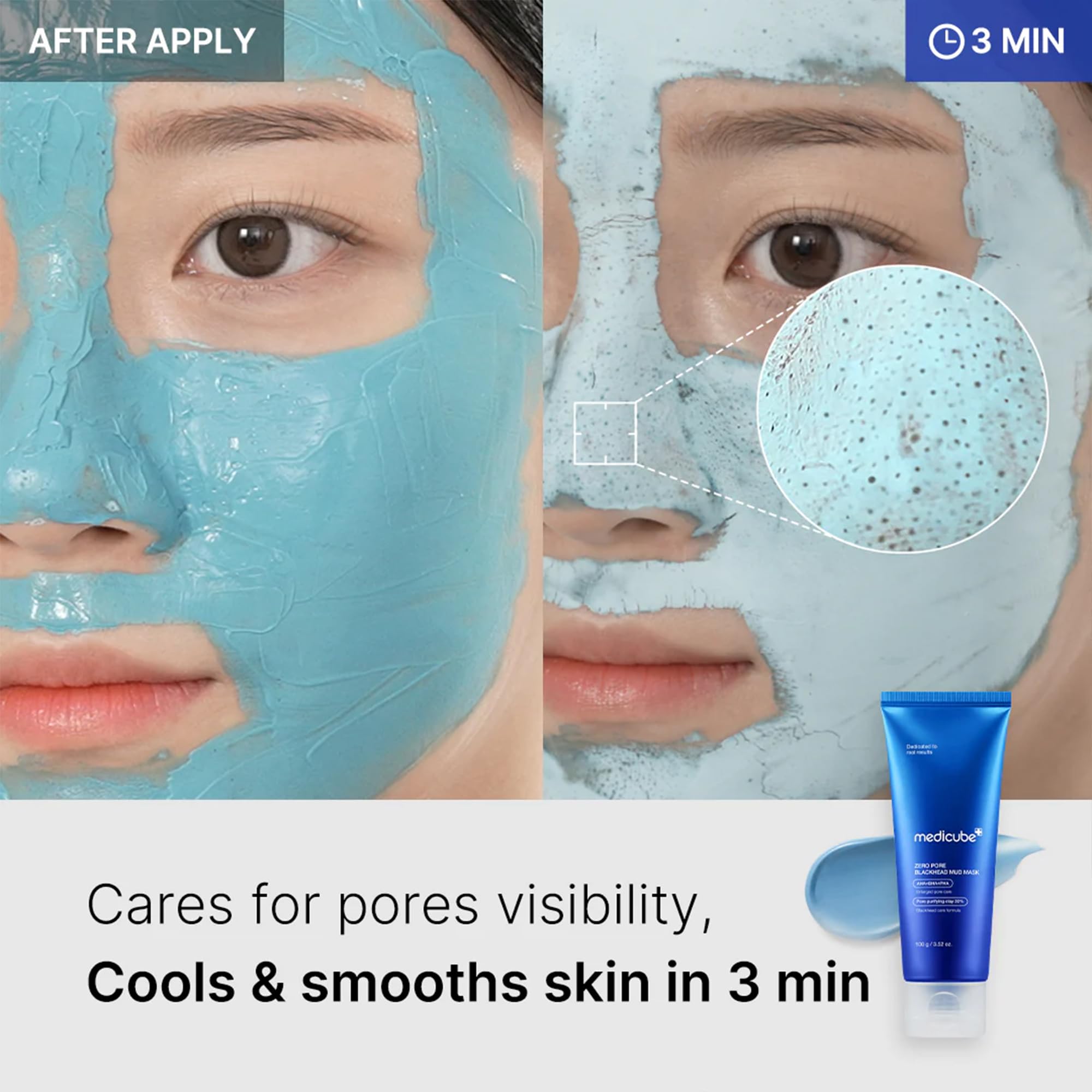Medicube Zero Pore Blackhead Mud Mask | Deep Pore Cleansing Treatment (100g)